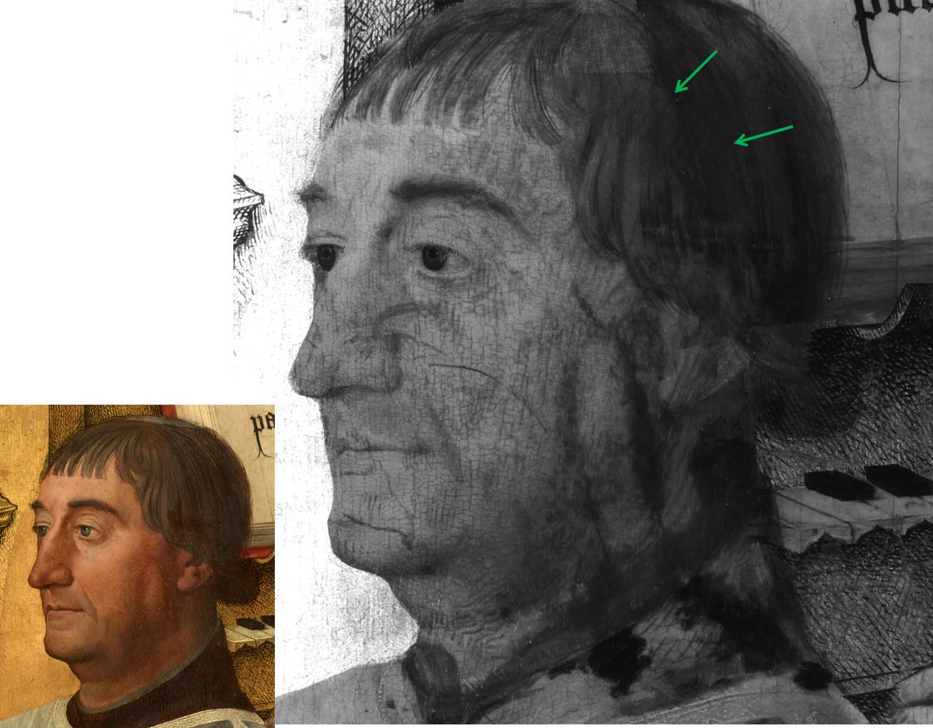 Infrared details of Edward Bonkill's head, showing repositioning of the head
