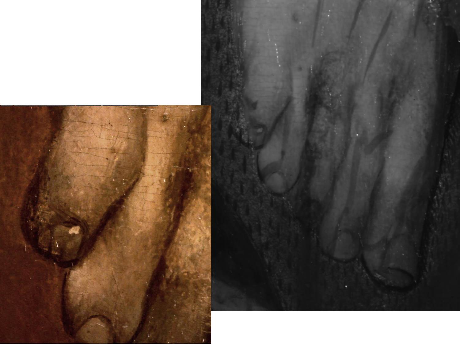 X-ray of Christ's feet