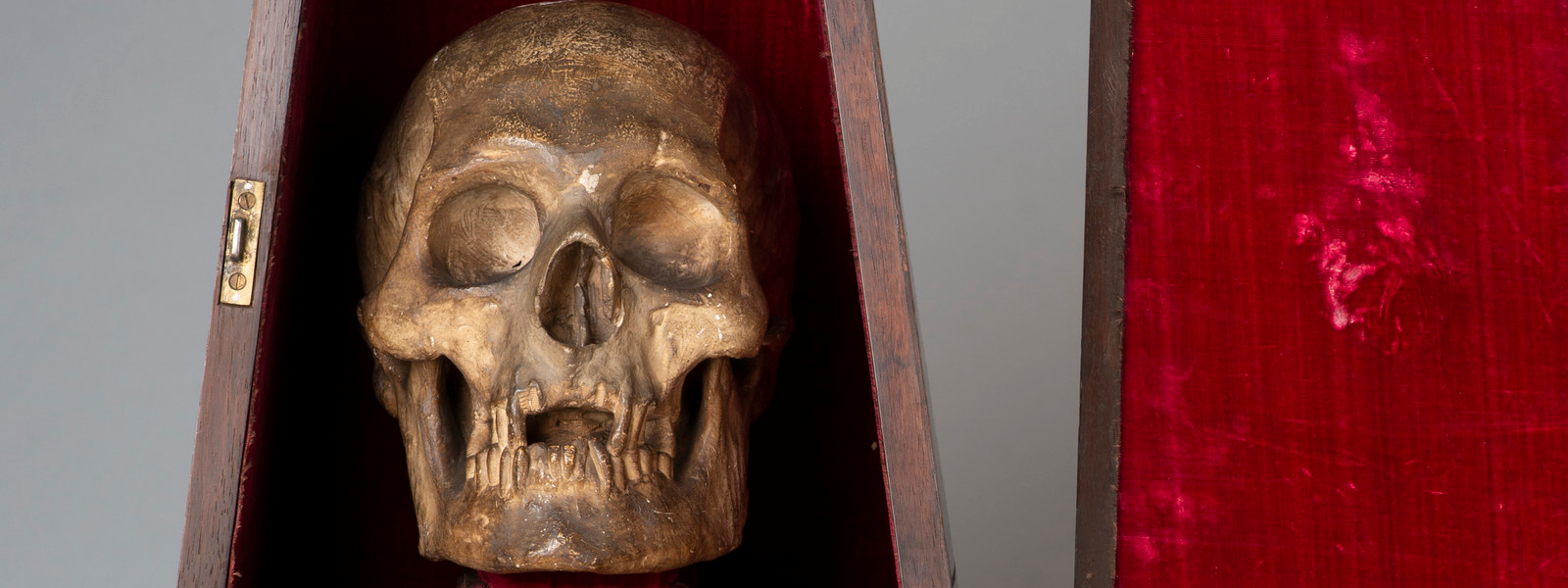 cast of Robert the Bruce's skull